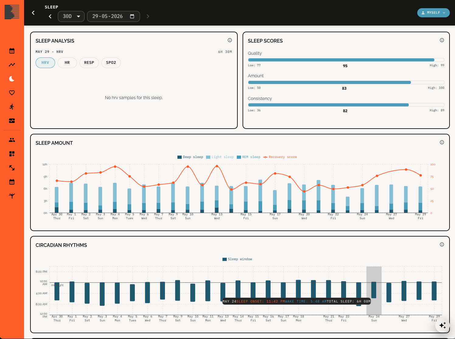 Beoflow Sleep Analysis Dashboard